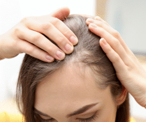 נשירת שיער אחרי לידה - PRP CLINIC טיפול בנשירה אחרי לידה
