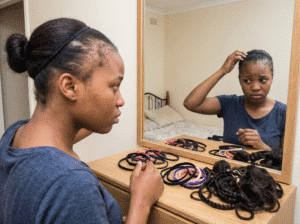 Traction Alopecia
